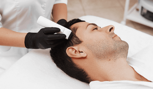 Derma Roller for Hair Loss/Hair Thinning