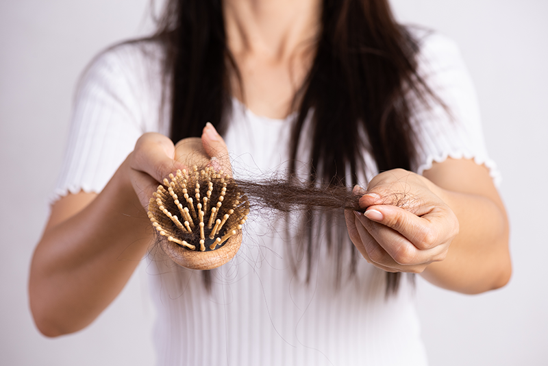 Female Pattern Baldness