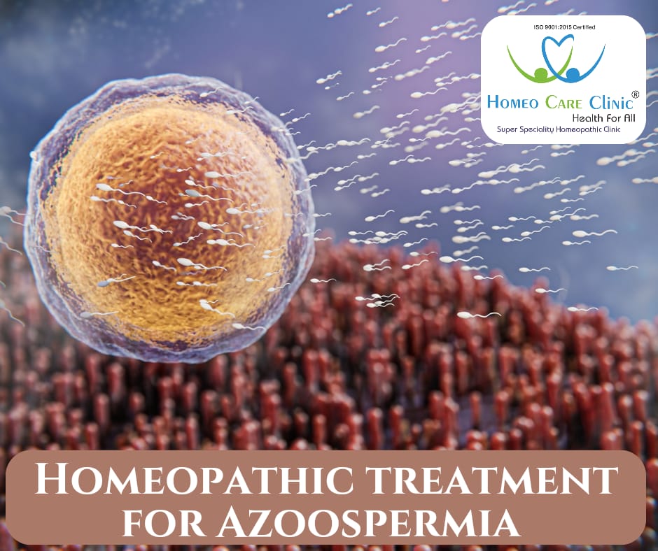 homeopathic treatment for azoospermia