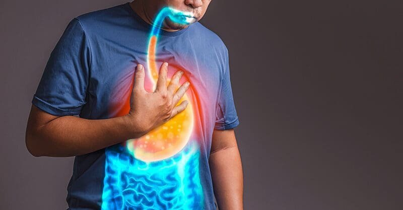 Homeopathic Treatment for Acidity