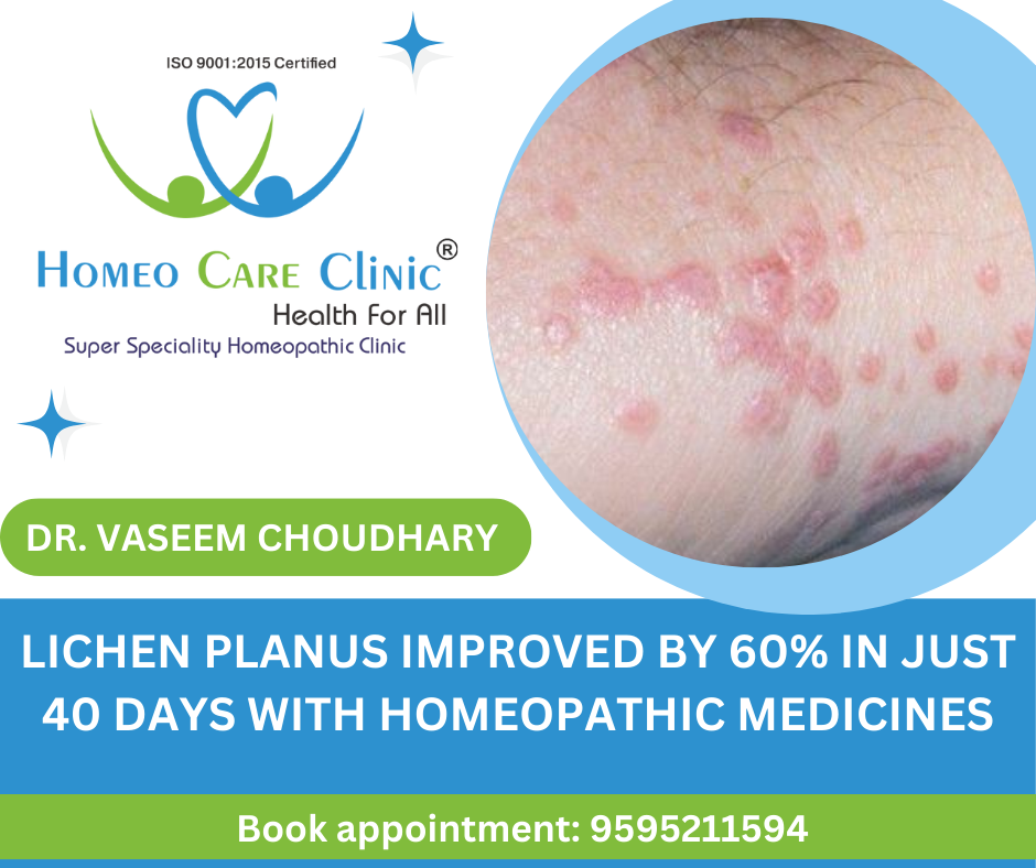 Homeopathic treatment for lichen planus showing improved skin condition