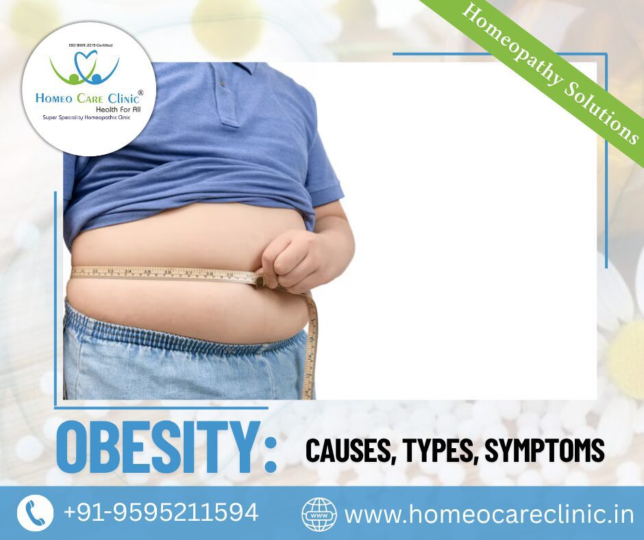 obesity causes