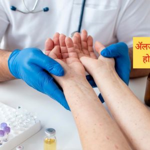 Allergies: Symptoms, Causes, and Homeopathic Treatment