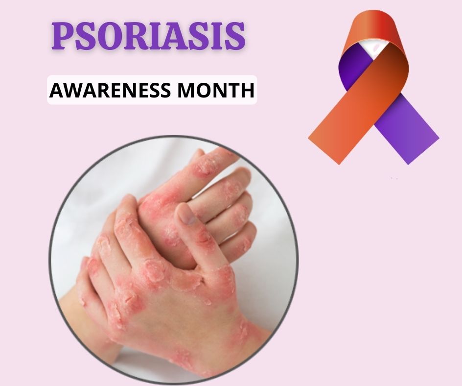PSORIASIS AWARENESS MONTH