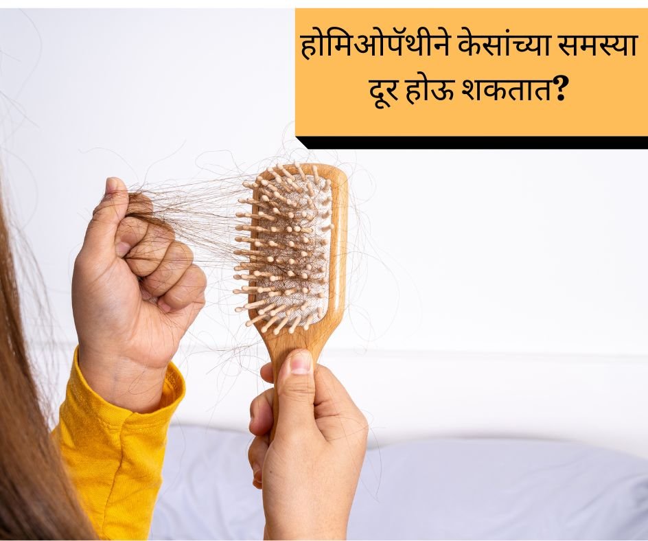 homeopathic treatment for hair fall in pune