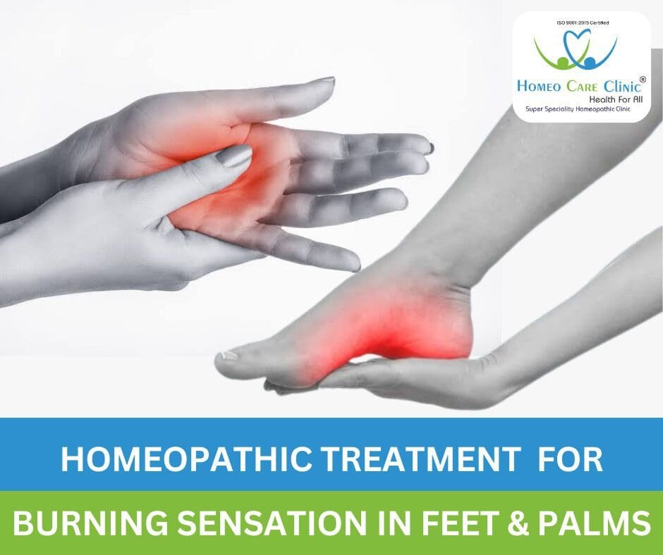 Homeopathic remedies for burning feet and palms