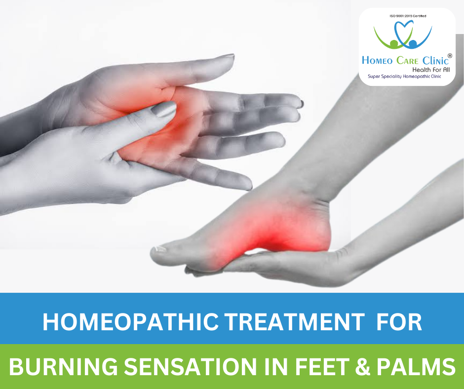 Homeopathic remedies for burning feet and palms