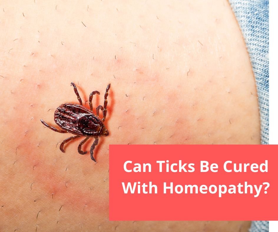 Tick Bite homeopathic treatment in pune