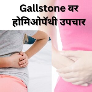 Homeopathy Treatment for Gallstone in Marathi