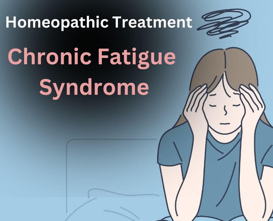 Homeopathic Treatment for Chronic Fatigue Syndrome | Dr. Vaseem Choudhary