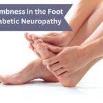 Numbness in the Foot-Diabetic Neuropathy | Dr. Vaseem Choudhary