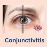 Conjunctivitis: Causes, Symptoms & Treatment by Dr. Vaseem Choudhary