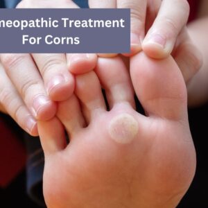 Homeopathic treatment for corns