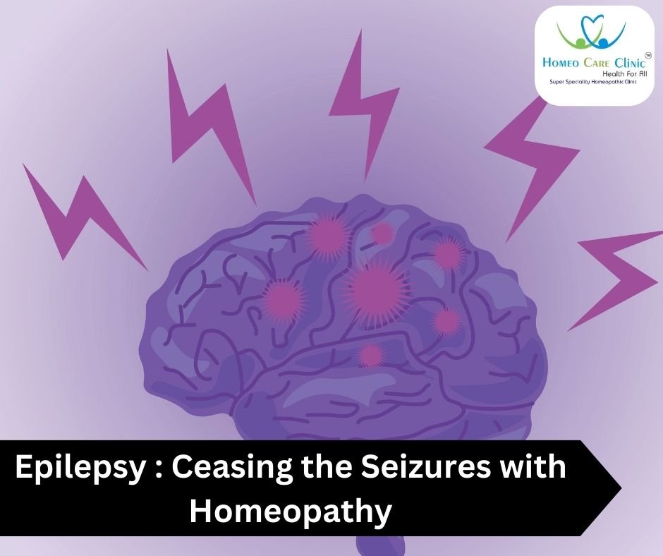 Epilepsy Ceasing the Seizures with Homeopathy | Dr. Vaseem Choudhary