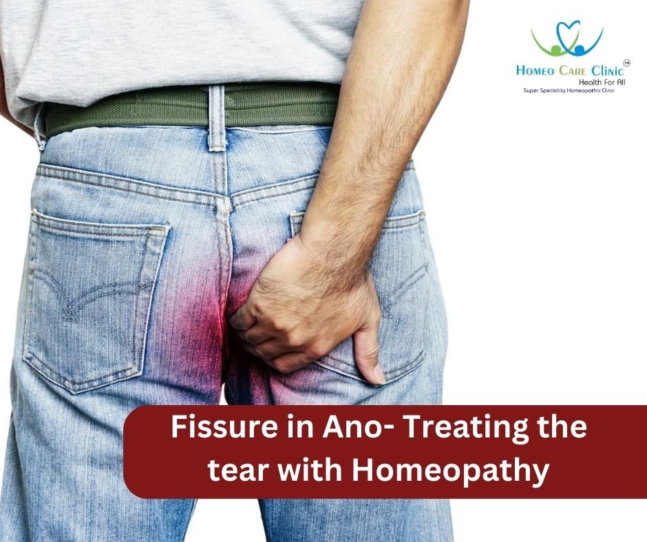 Fissure in Ano- Treating the tear with Homeopathy | Dr. Vaseem