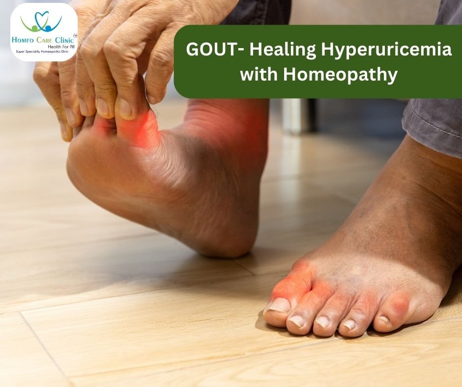 GOUT- Healing Hyperuricemia with Homeopathy | Dr. Vaseem Choudhary