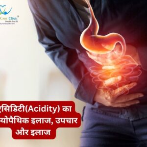 हाइपरएसिडिटी का इलाज