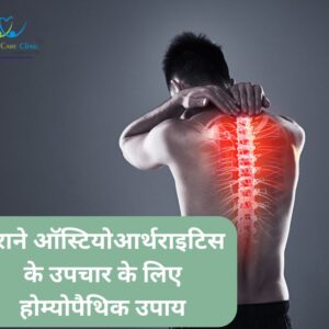 "Homeopathic Remedies for Treating Chronic Osteoarthritis"