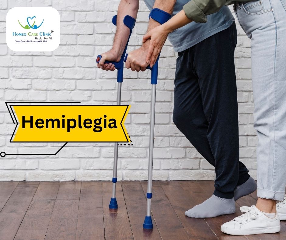 Hemiplegia - Embracing Homeopathy for Holistic Wellness | Dr. Vaseem Choudhary