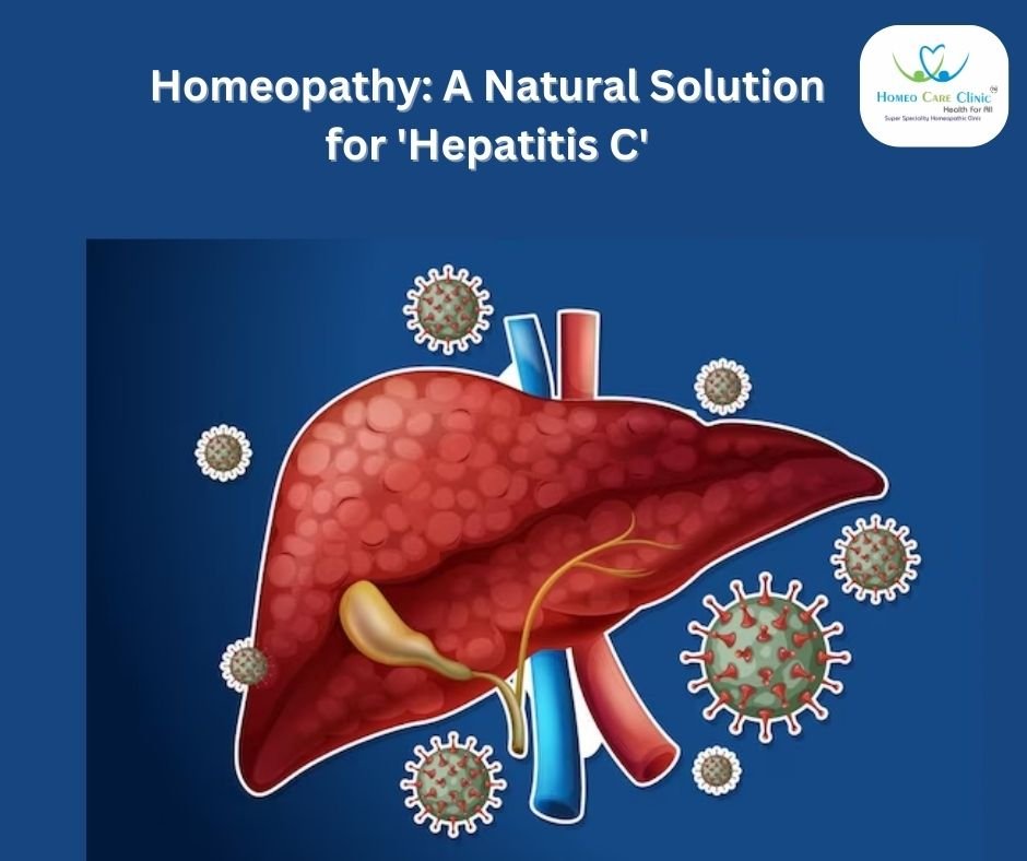 Homeopathic Treatment For Hepatitis C | Dr. Vaseem Choudhary