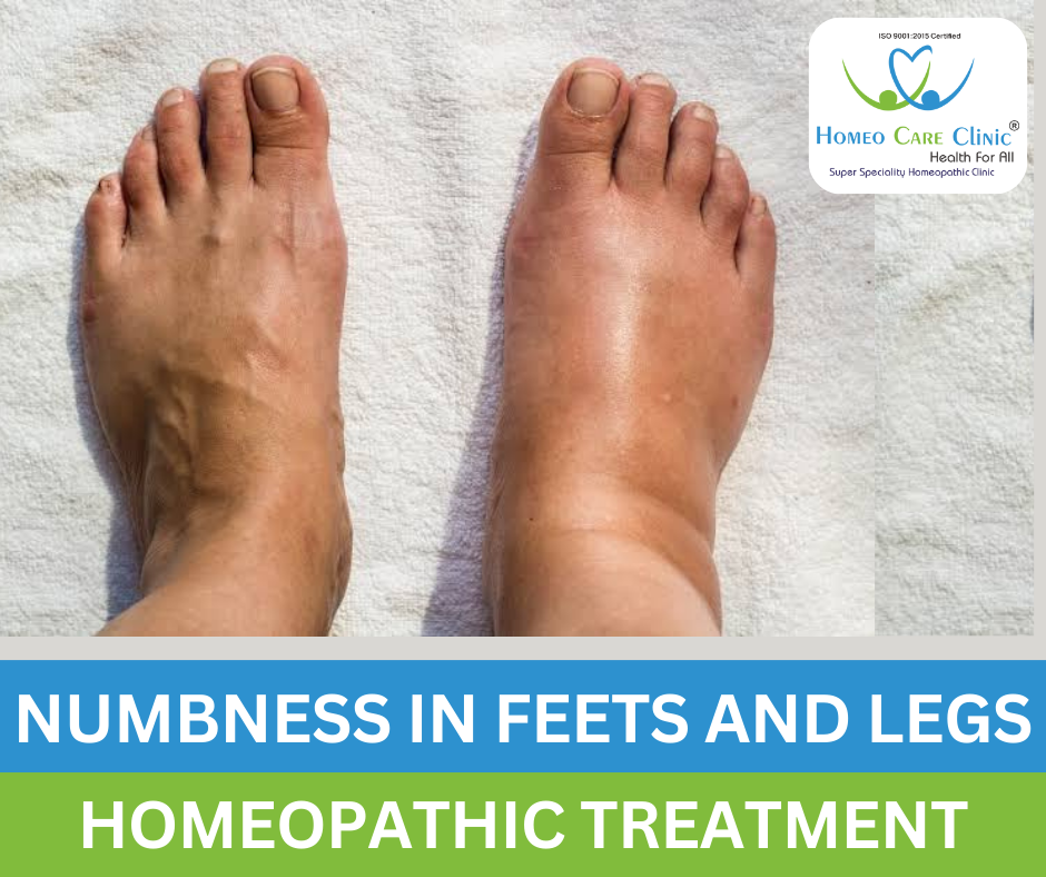 treatment options for numbness in feet and legs