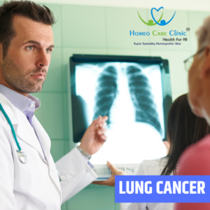 Homeopathic remedies for lung cancer treatment support