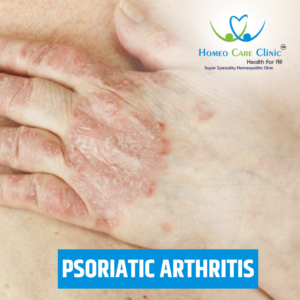 Psoriatic Arthritis