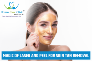 Laser Peel for Skin
