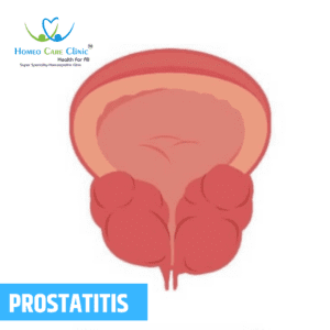 Homeopathy for prostatitis treatment