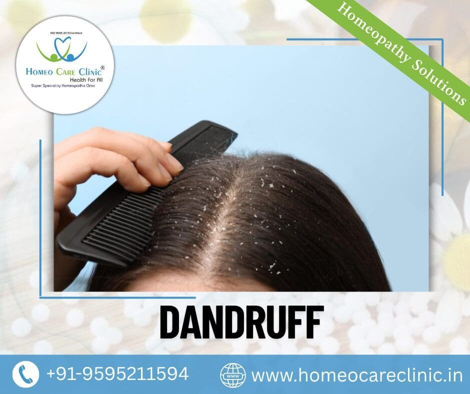 dandruff treatment