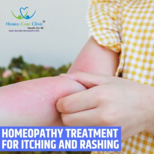 Homeopathy Treatment for itcching and rashing