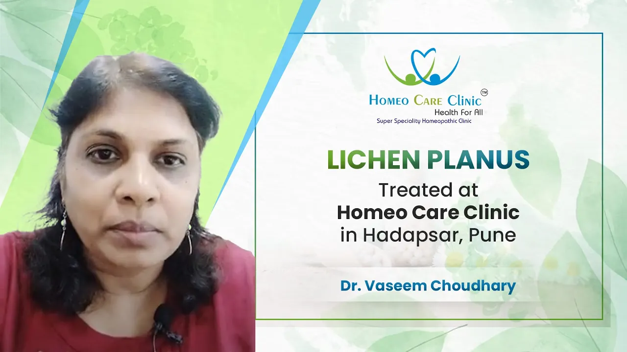 Lichen Planus Homeopathy Cure