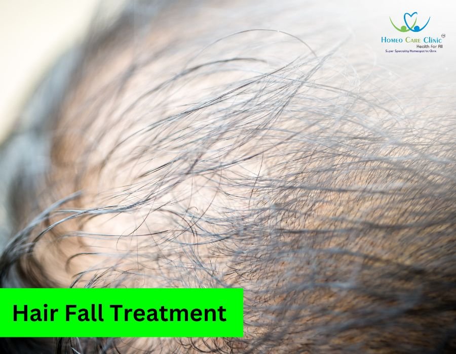 Hair fall Treatment | Homeo Care Clinic | Dr. Vaseem Choudhary