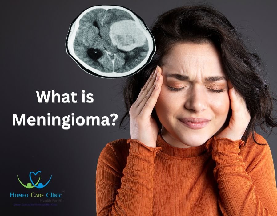 What is Meningioma? | Homeopathic Medicines for Meningioma