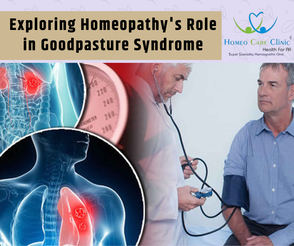 Goodpasture Syndrome Homeopathys treatment