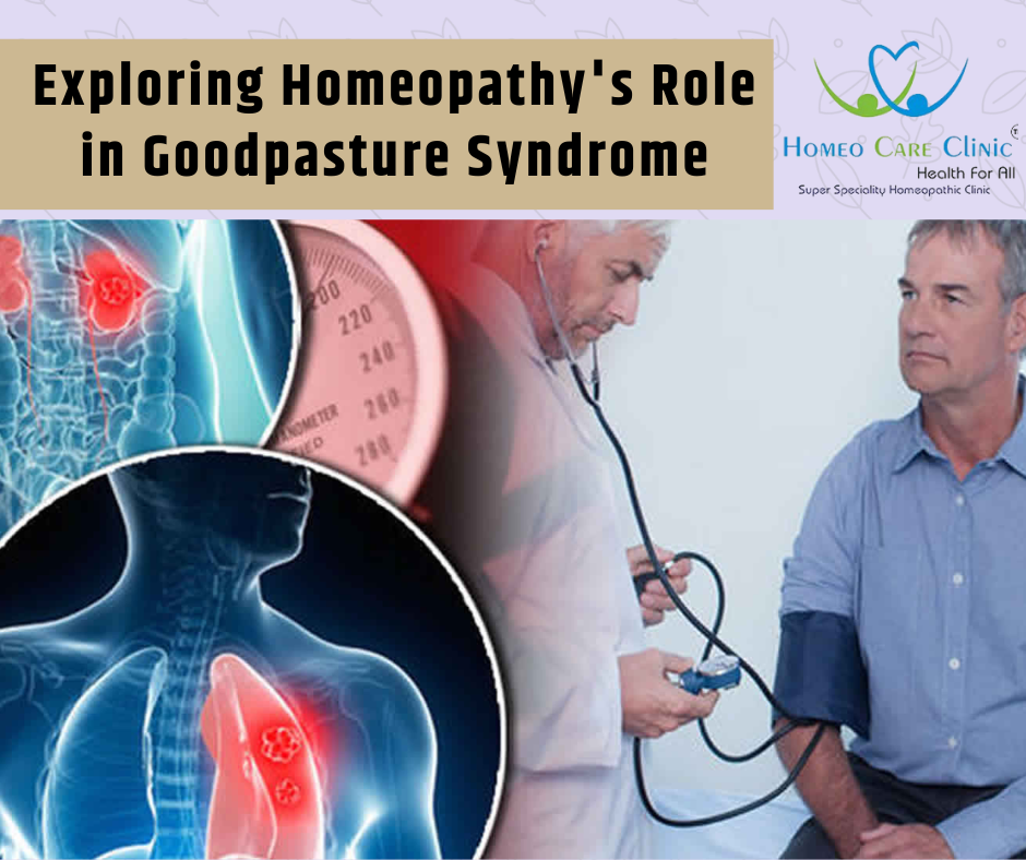 Exploring Homeopathy's Role in Goodpasture Syndrome