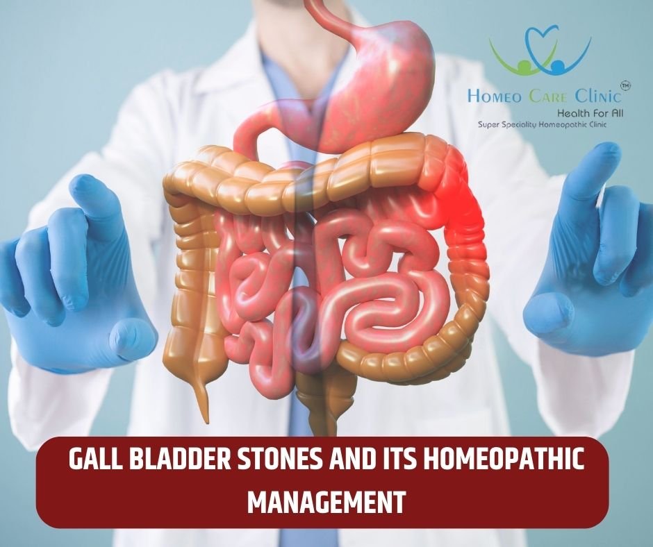 Gallbladder stones