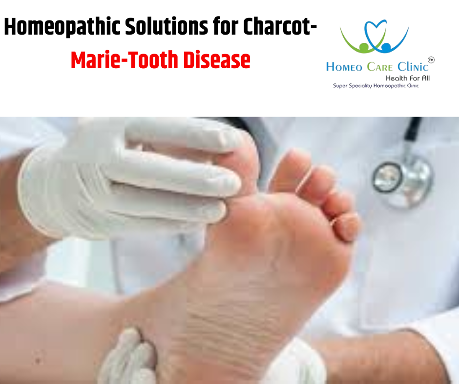 Charcot Marie Tooth Disease treatment