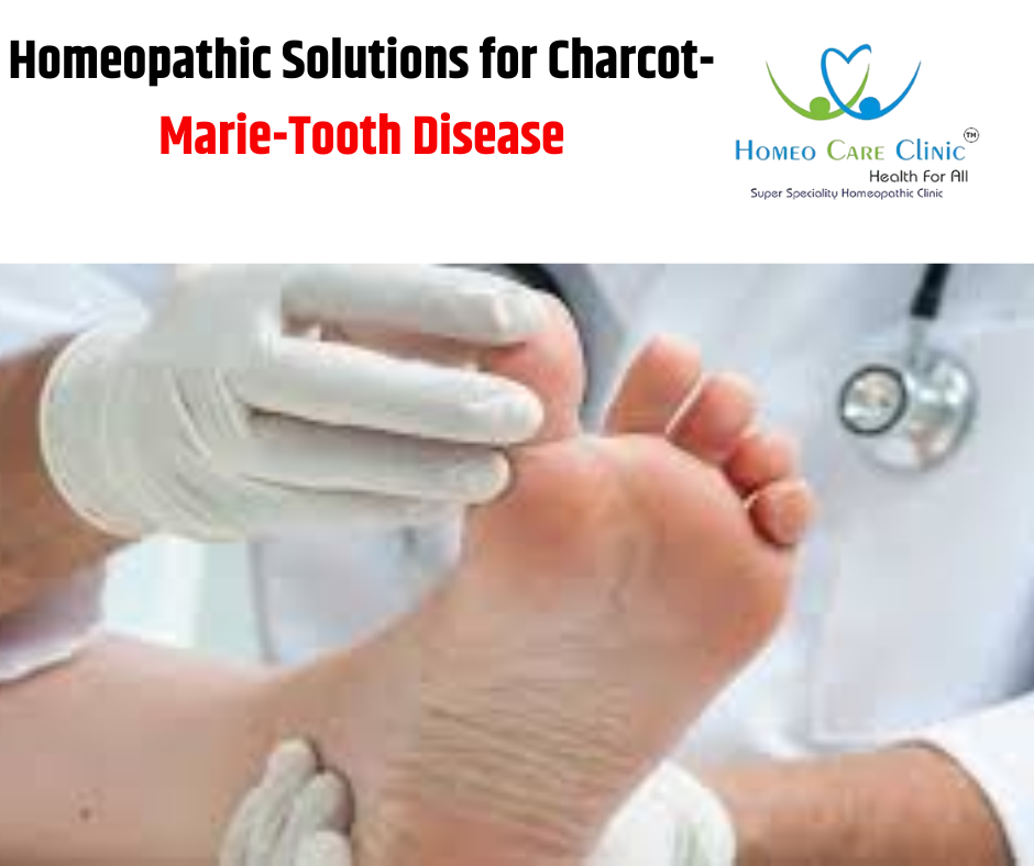 Homeopathic Solutions for Charcot-Marie-Tooth Disease