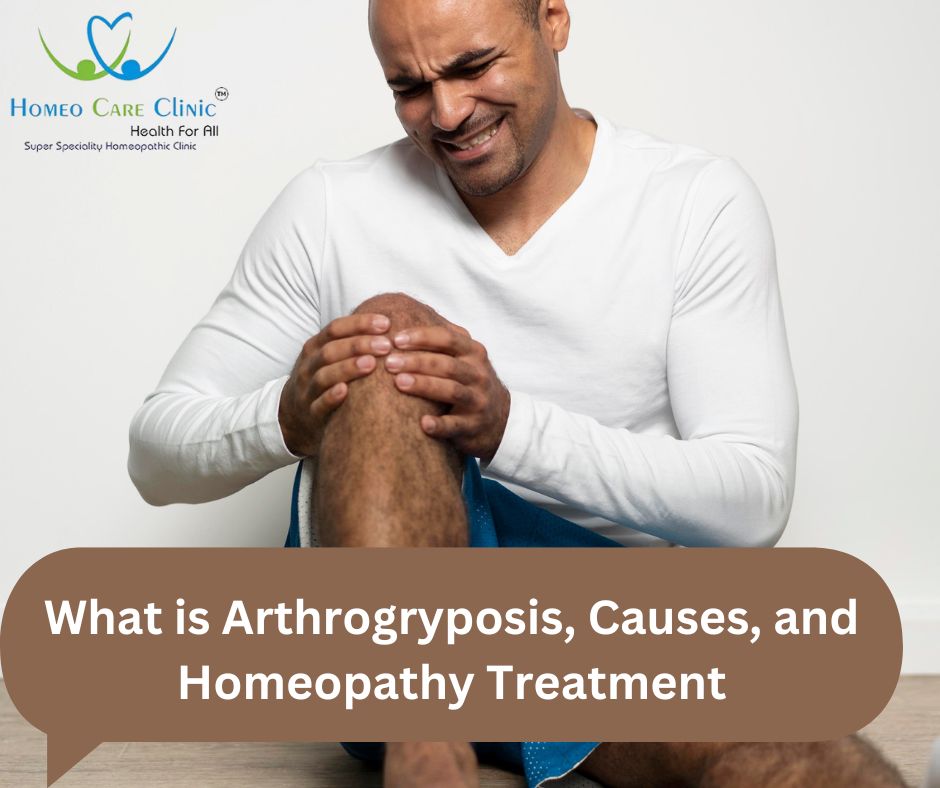 Arthrogryposis Causes