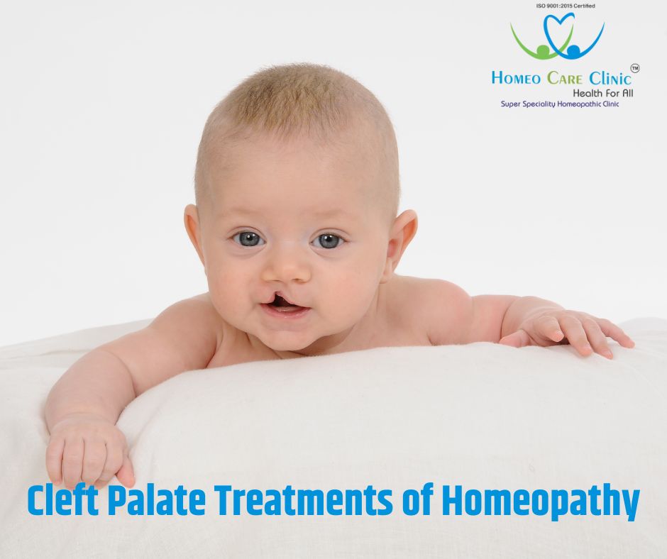 Cleft Palate Treatments