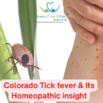 Colorado Tick fever & Its Homeopathic insight