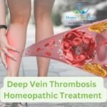 Deep Vein Thrombosis & Its Homeopathic Approach