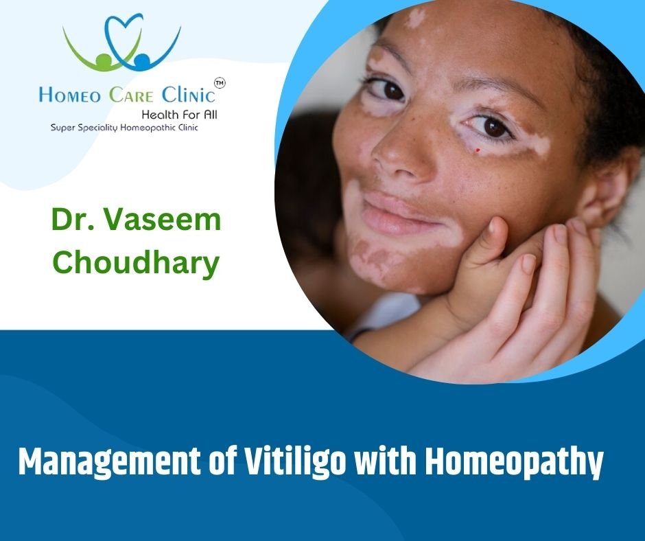 mangement of vitiligo with homeopathy