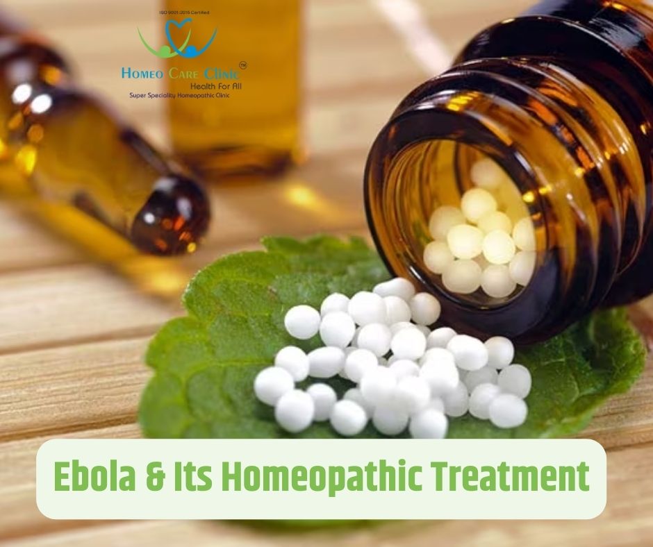 Ebola and treatment