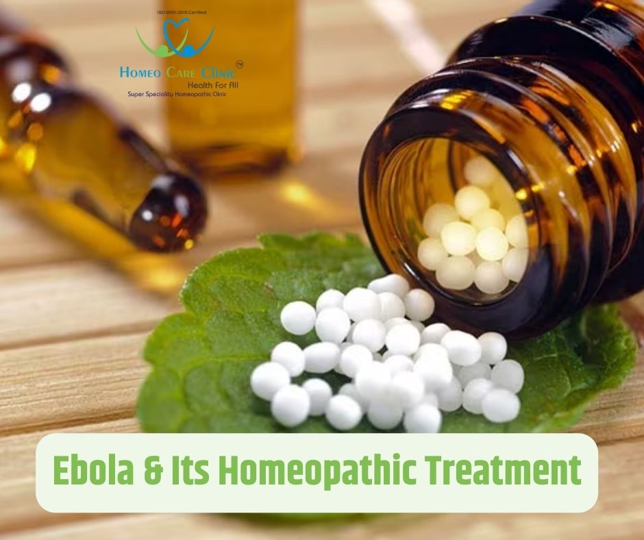 homeopathy treatment of ebola