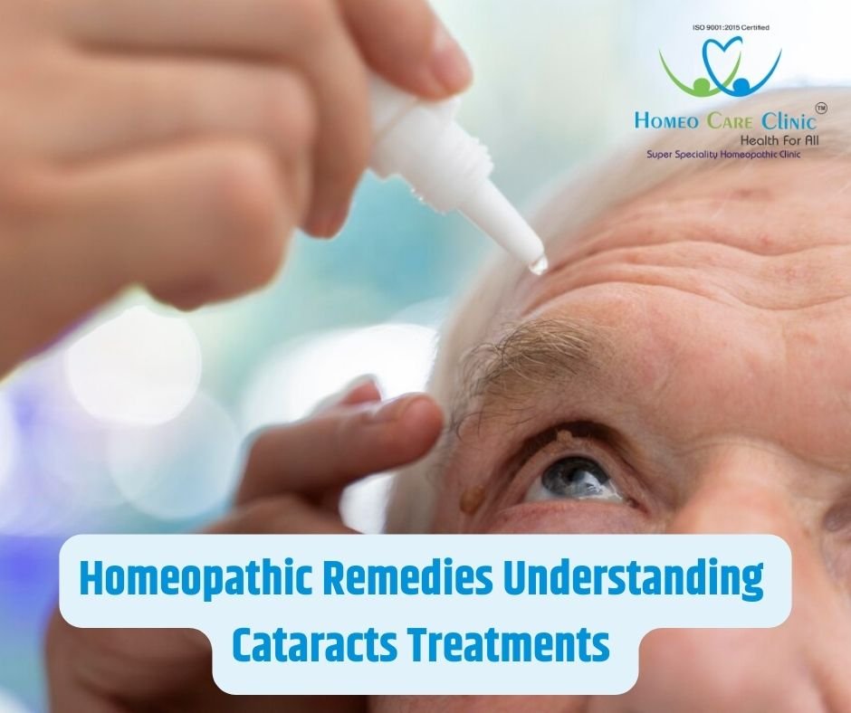 Discover the gentle and personalized approach of homeopathy in treating cataracts, improving vision and overall eye health. Learn about effective remedies like Calcarea fluorica, Silicea, and more at Homeo Care Clinic