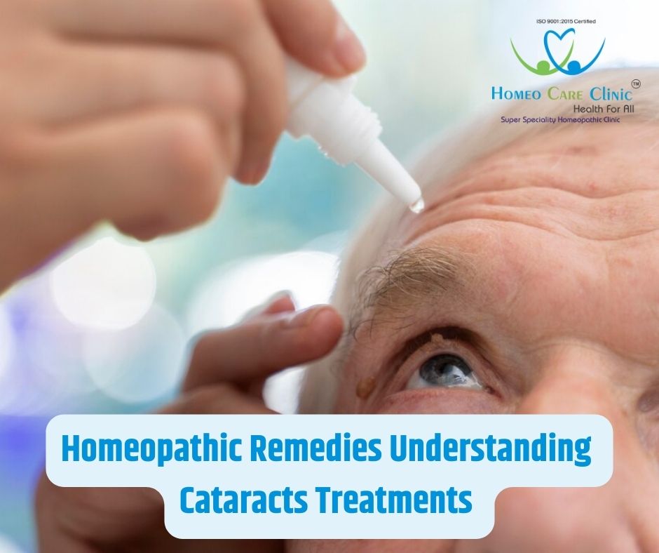 Discover the gentle and personalized approach of homeopathy in treating cataracts, improving vision and overall eye health. Learn about effective remedies like Calcarea fluorica, Silicea, and more at Homeo Care Clinic