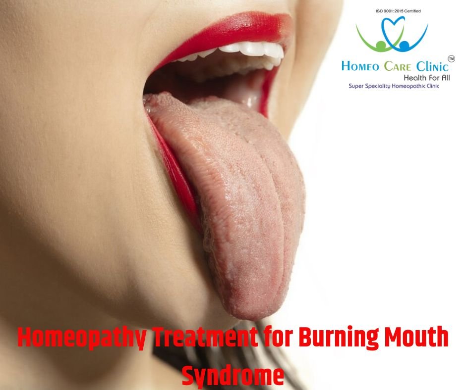 homeopathy treatment for burning mouth syndrome