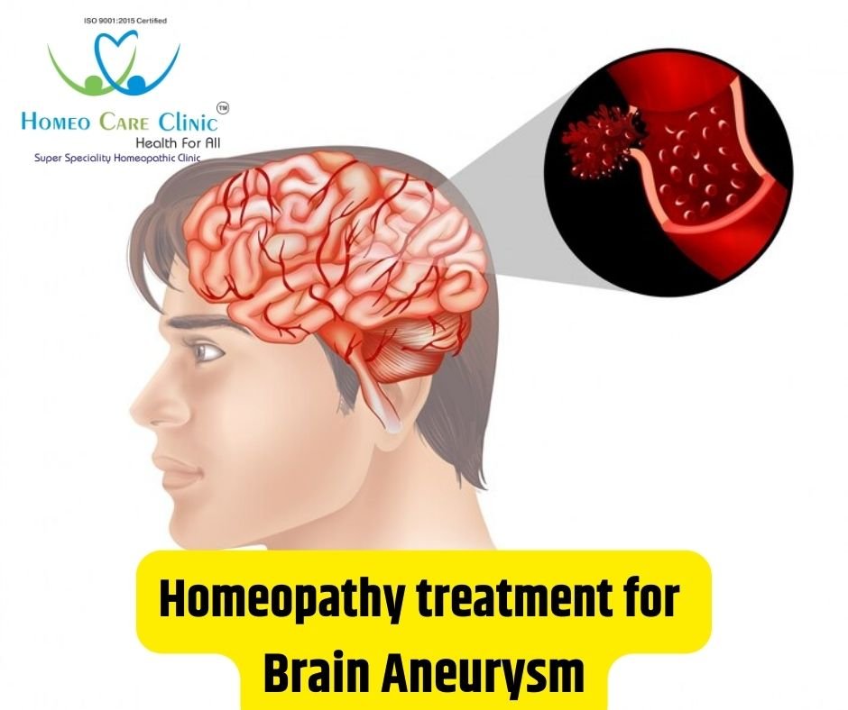 homeopathy treatment for brain aneurysm